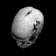 Sichtbar ein menschlicher Schädel von schräg oben